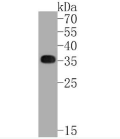 Anti-HLA-DR antibody-HLA-DR重组兔单抗