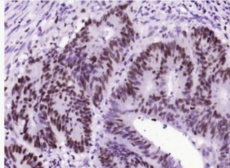 Anti-phospho-C-Myc (Ser62)antibody-磷酸化致癌基因C-Myc重组兔单抗