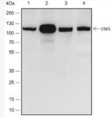 Anti-ERK5 antibody-细胞外信号调节激酶5重组兔单抗