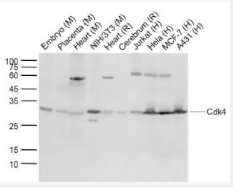 Anti-Cdk4 antibody-周期素依赖性激酶4单克隆抗体