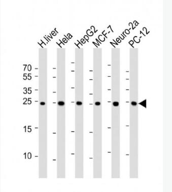 Anti-PSMA5 antibody-蛋白酶体PSMα5单克隆抗体