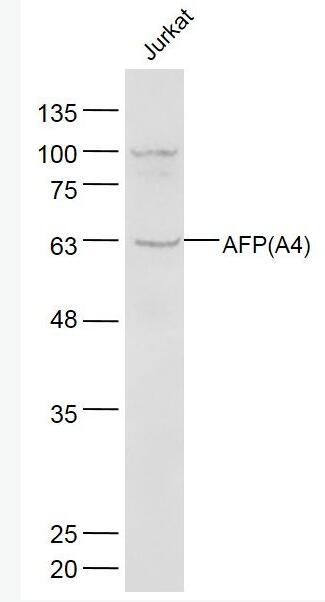 Anti-AFP(A4)   antibody-甲胎蛋白单克隆抗体(检测)