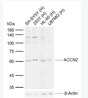 Anti-ACCN2 antibody-酸敏感离子通道1抗体