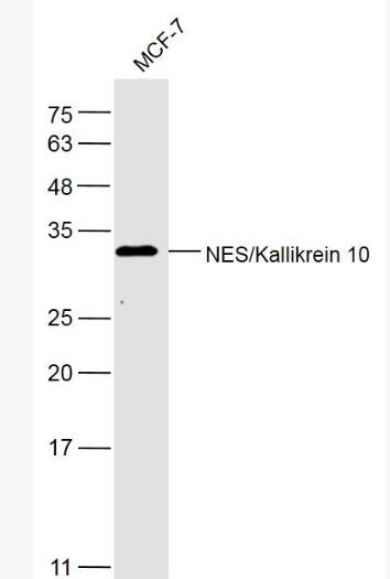 Anti-NES/Kallikrein 10  antibody-上皮细胞特异性蛋白1抗体