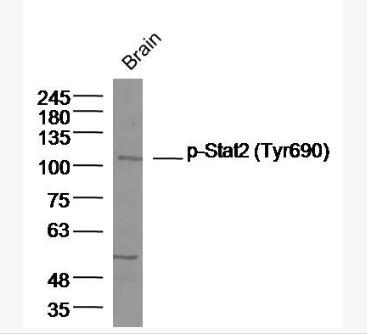Anti-Phospho-Stat2 (Tyr690) antibody-磷酸化信号转导和转录激活因子2抗体
