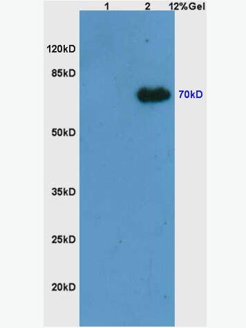 Anti-Phospho-Syk (Tyr525 + Tyr526) antibody-磷酸化非受体型酪氨酸蛋白激酶抗体