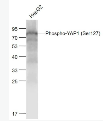 Anti-Phospho-YAP1 (Ser127) antibody-磷酸化原癌基因Yes相关蛋白1重组兔单抗