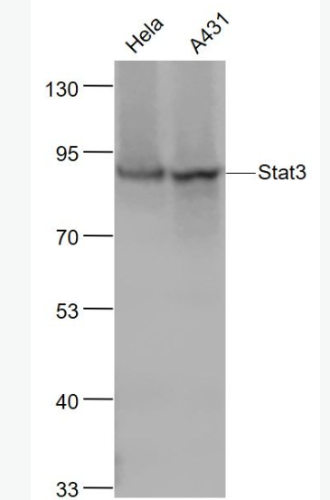 Anti-STAT3 antibody-信号转导和转录激活因子3重组兔单抗