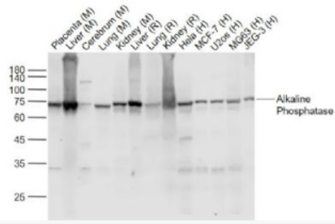 Anti-Alkaline phosphatase, tissue-nonspecific isozyme antibody-碱性磷酸酶重组兔单抗