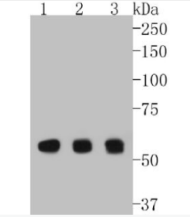 Anti-Cyclin B1 antibody-周期素B1重组兔单抗