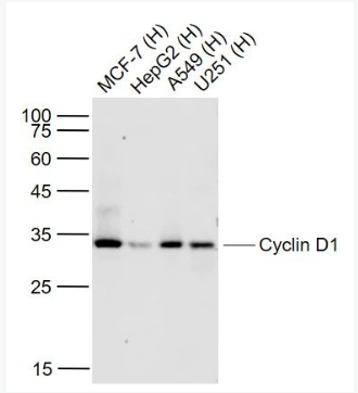 Anti-Cyclin D1 antibody-周期素D1重组兔单抗