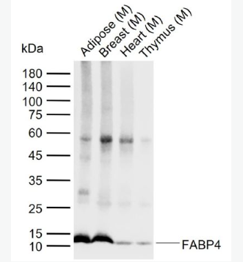 Anti-FABP4  antibody-脂肪细胞型脂肪酸结合蛋白单克隆抗体