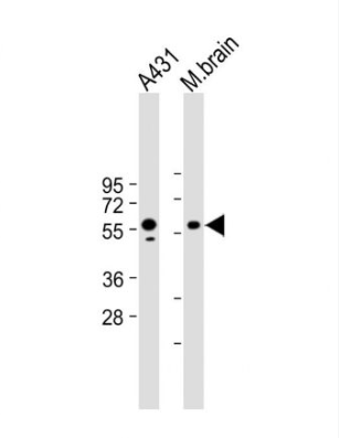 Anti-PINK1  antibody-丝氨酸/苏氨酸蛋白激酶PINK1单克隆抗体