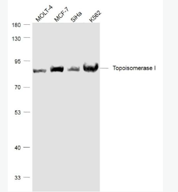 Anti-Topoisomerase I antibody-拓普西异构酶Ⅰ单克隆抗体