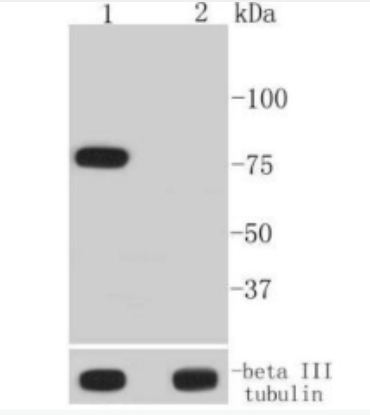 Anti-Phospho-BTK (Tyr223) antibody-磷酸化酪氨酸蛋白激酶BTK重组兔单抗