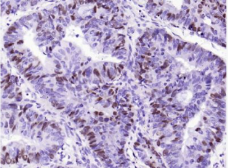 Anti-Phospho-Rb (Ser807) antibody-磷酸化视网膜母细胞瘤相关蛋白1重组兔单抗
