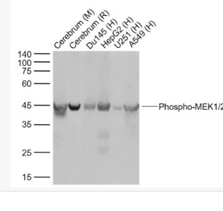 Anti-Phospho-MEK1/2 (Ser218 + Ser222)antibody-磷酸化丝裂原活化蛋白激酶激酶1/2重组兔单抗