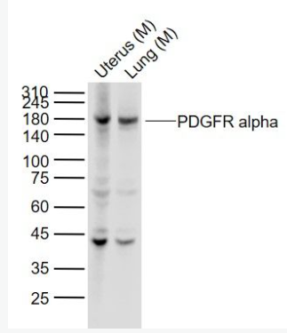 Anti-PDGFR alphaantibody-PDGFRα重组兔单抗