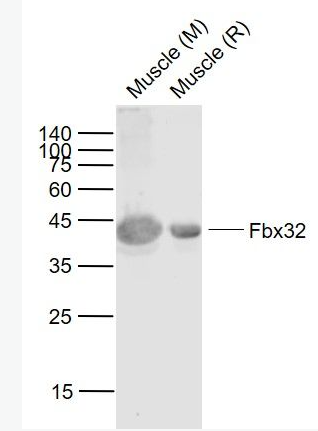 Anti-Fbx32 antibody-泛素蛋白连接酶重组兔单抗