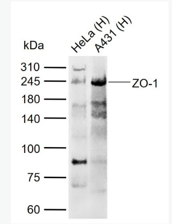 Anti-ZO-1 antibody-胞质紧密粘连蛋白1/闭锁小带蛋白1抗体