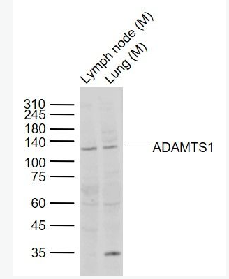 Anti-ADAMTS1  antibody-整合素样金属蛋白酶与凝血酶1型抗体