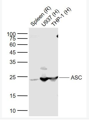 Anti-ASC/TMS1 antibody-凋亡相关斑点样蛋白ASC抗体