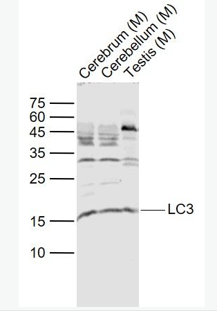 Anti-LC3 antibody-自噬微管相关蛋白轻链3抗体