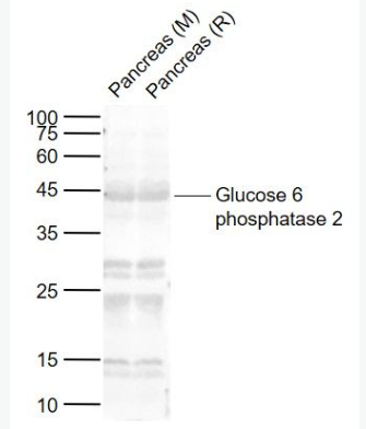 Anti-Glucose 6 phosphatase 2 antibody-胰岛葡萄糖6磷酸酶2抗体