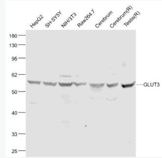 Anti-GLUT3 antibody-葡萄糖转运蛋白3抗体