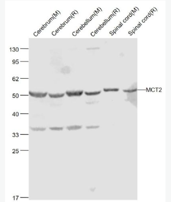 Anti-MCT2 antibody-单羧酸转运蛋白2抗体