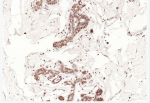 Anti-CDKN2A/P14arf antibody-抑癌基因p16/p14/P19抗体
