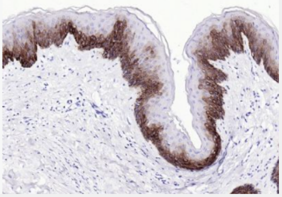 Anti-MUC1 antibody-粘蛋白-1抗体