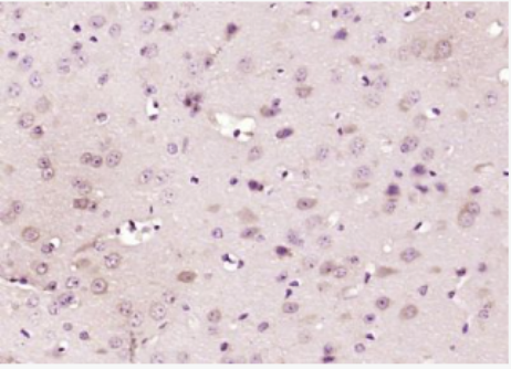 Anti-SRD5A1 antibody-类固醇5α还原酶1抗体(5α-Reductase 1)