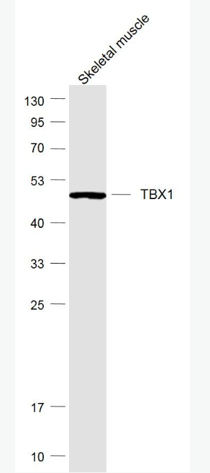 Anti-TBX1 antibody-先心病相关蛋白TBX1抗体