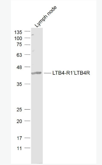 Anti-LTB4-R1/LTB4R antibody-白三烯B4受体1抗体