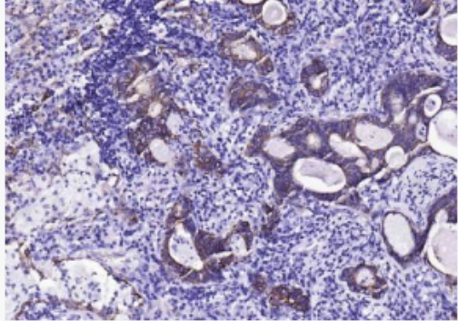 Anti-ox-LDL antibody-氧化低密度脂蛋白单克隆抗体