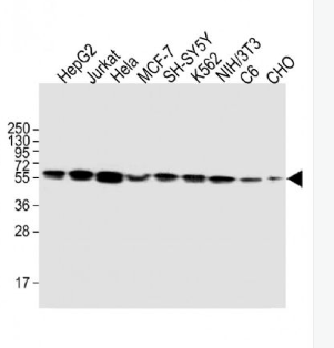 Anti-Calreticulin antibody-钙网蛋白单克隆抗体