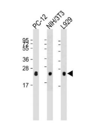 Anti-RHOA antibody-RHOA单克隆抗体