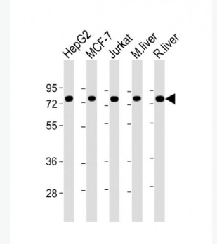Anti-GRP78 antibody-葡萄糖调节蛋白78单克隆抗体
