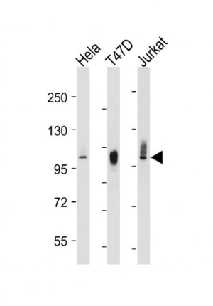 Anti-LAMP2 antibody-溶酶体相关膜蛋白2（CD107B）单克隆抗体