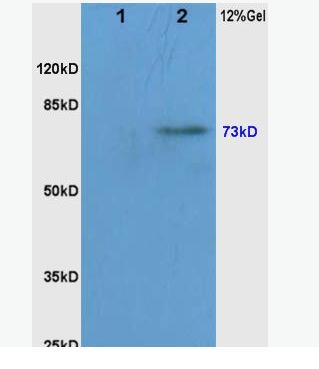 Anti-phospho-RAF1 (Ser338/Tyr340) antibody-磷酸化原癌基因RAF1抗体