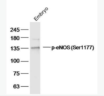 Anti-Phospho-eNOS (Ser1177) antibody-磷酸化一氧化氮合成酶3（内皮型）抗体