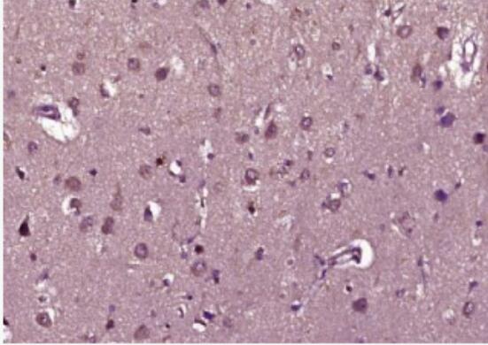 Anti-Phospho-Raptor (Ser792) antibody-磷酸化mTOR相关调控蛋白抗体