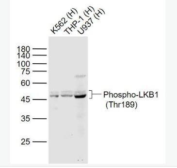 Anti-Phospho-LKB1 (Thr189) antibody-磷酸化丝氨酸/苏氨酸蛋白激酶抗体