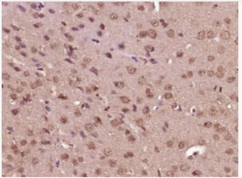 Anti-phospho-MEK1 (Thr286) antibody-磷酸化丝裂原活化蛋白激酶激酶1抗体