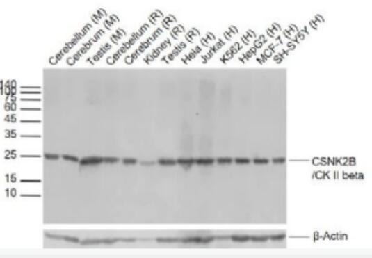 Anti-CSNK2B/CK II betaantibody-丝/苏氨酸蛋白激酶II β重组兔单抗