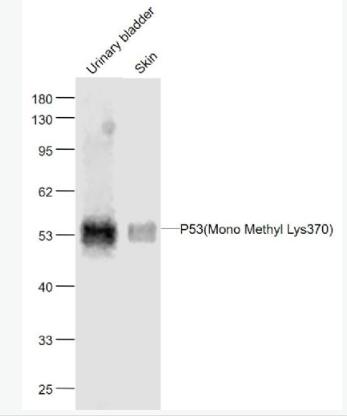 Anti-P53(Mono Methyl Lys370) antibody-甲基化P53(Mono Methyl Lys370)单克隆抗体
