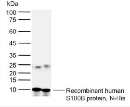 Anti-S100B antibody-人S100B蛋白多克隆抗体