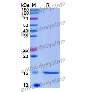 Anti-Human MAGEB1 Nanobody (SAA1034)