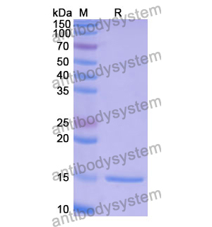 Anti-Human MAGEB1 Nanobody (SAA1250)